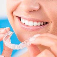 All You Need To Know About Invisalign