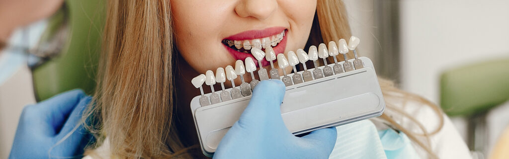 Transform Your Smile: The Ultimate Guide to Custom Veneers