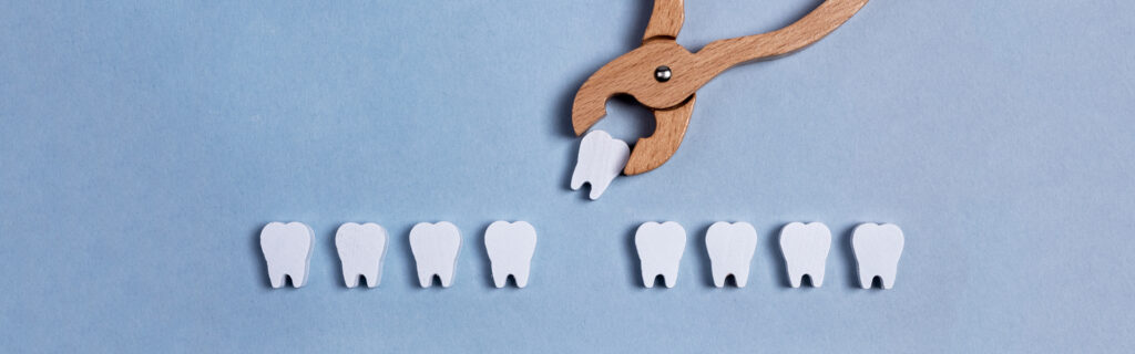 Why Tooth Extractions Are Sometimes the Healthiest Choice