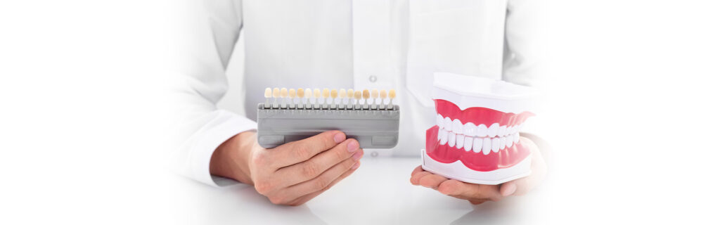 How to Choose the Right Shade of Dental Veneers?