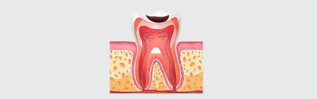Signs You Might Need Root Canal Therapy: When to See Your Dentist